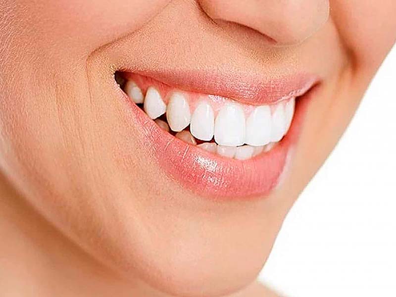 estetica dental getafe