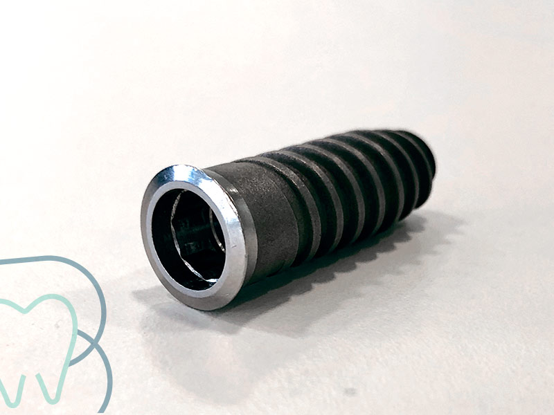 implante dental getafe y arganzuela