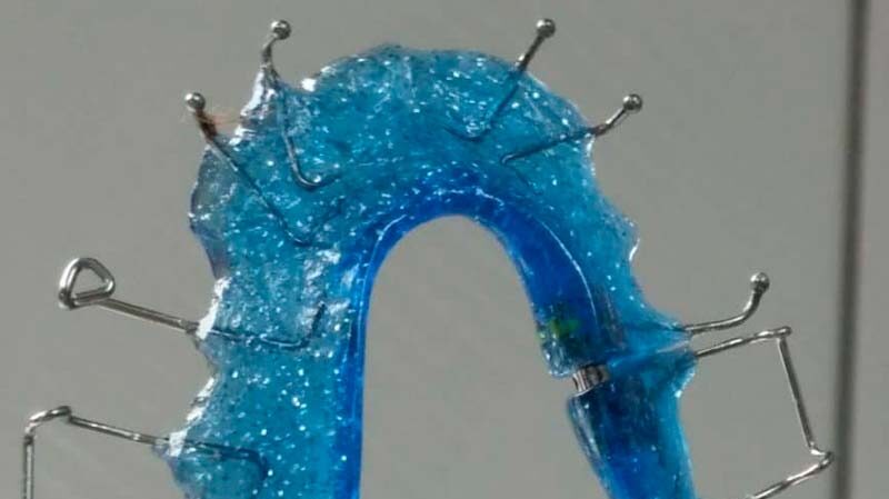 ortodoncias arganzuela