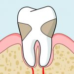 periodoncia arganzuela