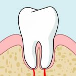 periodoncias arganzuela