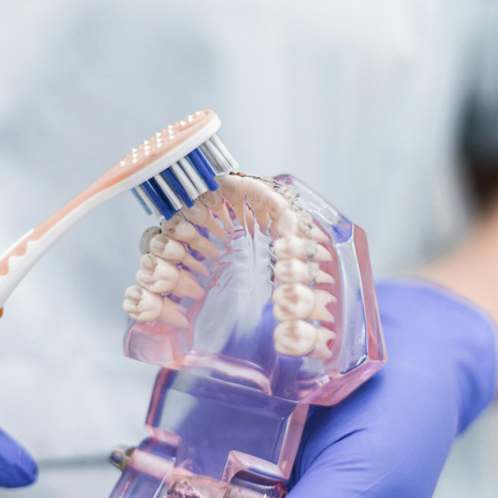 maneras saber si necesitas limpieza dental